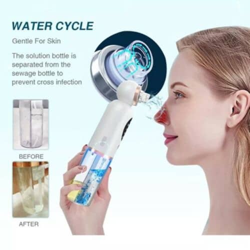 Vacuum Electric Facial Cleansing Care Instrument Pore Cleaner Blackhead Remover