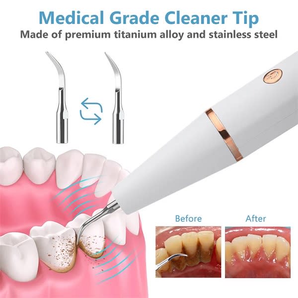 Home Use Rechargeable Electric  Teeth Cleaner